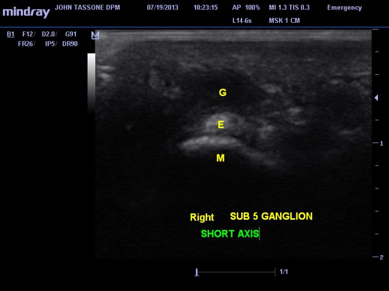image of ultrasound